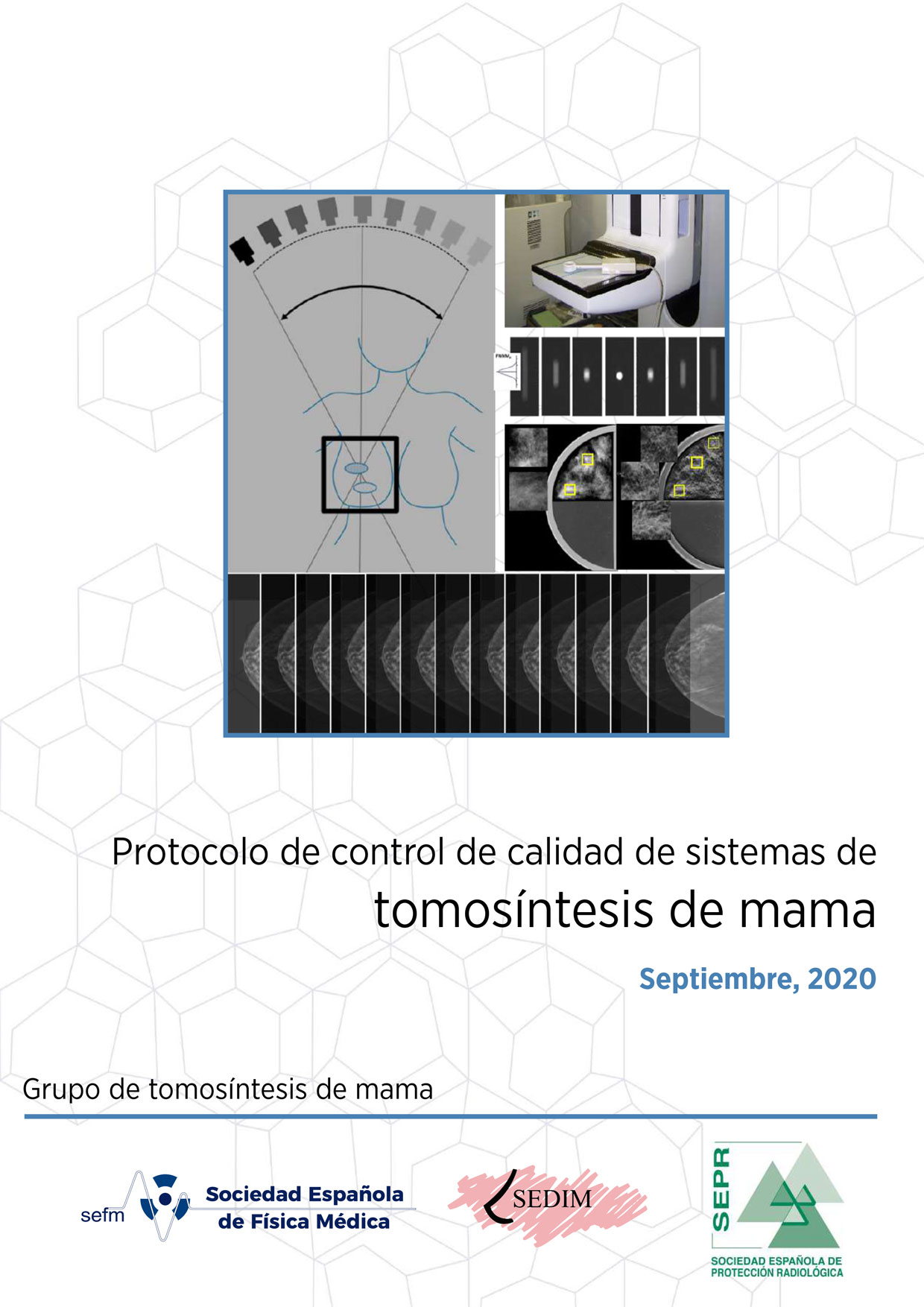 Tomosintesis de mama final 2 1